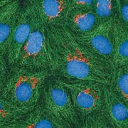 Zelluläre Seneszenz und Senolytika