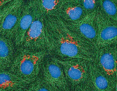 Zelluläre Seneszenz und Senolytika