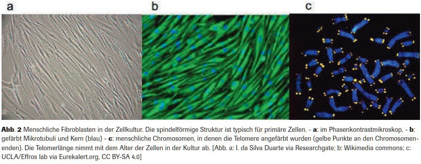 Abb. 2 Menschliche Fibroblasten in der Zellkultur. Die spindelförmige Struktur ist typisch für primäre Zellen. - a: im Phasenkontrastmikroskop, - b: gefärbt Mikrotubuli und Kern (blau) - c: menschliche Chromosomen, in denen die Telomere angefärbt wurden (gelbe Punkte an den Chromosomen- enden). Die Telomerlänge nimmt mit dem Alter der Zellen in der Kultur ab. [Abb. a: I. da Silva Duarte via Researchgate; b: Wikimedia commons; c: UCLA/Effros lab via Eurekalert.org, CC BY-SA 4.0]