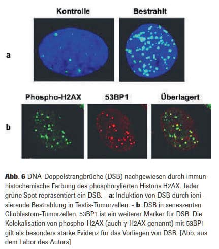 Abb. 6 DNA-Doppelstrangbrüche (DSB) nachgewiesen durch immunhistochemische Färbung des phosphorylierten Histons H2AX. Jeder grüne Spot repräsentiert ein DSB. - a: Induktion von DSB durch ionisierende Bestrahlung in Testis-Tumorzellen. - b: DSB in seneszenten Glioblastom-Tumorzellen. 53BP1 ist ein weiterer Marker für DSB. Die Kolokalisation von phospho-H2AX (auch γ-H2AX genannt) mit 53BP1 gilt als besonders starke Evidenz für das Vorliegen von DSB. [Abb. aus dem Labor des Autors]